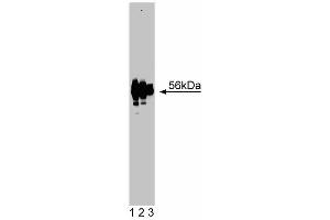 Western blot analysis of Lck on jurkat lysate. (LCK anticorps  (AA 1-191))