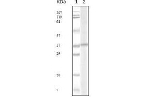 Western blot analysis using KSHV ORF62 mouse mAb against KSHV ORF62 recombinant protein. (KSHVORF62 anticorps)