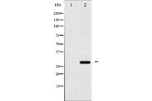 Western blot analysis of 14-3-3 zeta phosphorylation expression in UV treated NIH-3T3 whole cell lysates,The lane on the left is treated with the antigen-specific peptide.