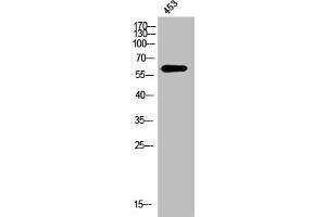 Western Blot analysis of 453 cells using OPN Polyclonal Antibody