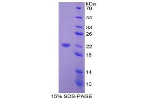 SDS-PAGE (SDS) image for Vitamin D Receptor (VDR) (AA 266-422) protein (His tag) (ABIN1980745) (Vitamin D Receptor Protein (VDR) (AA 266-422) (His tag))