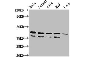 Western Blot Positive WB detected in: Hela whole cell lysate, Jurkat whole cell lysate, A549 whole cell lysate, 293 whole cell lysate, Rat lung tissue All lanes: MAPK1 antibody at 4. (ERK2 anticorps  (AA 310-360))