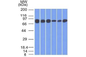 Western Blot of HT20, 293, A431, MCF-7, HepG2 and A549 cell lysates using Catenin, gamma Mouse Monoclonal Antibody (15F11). (JUP anticorps)