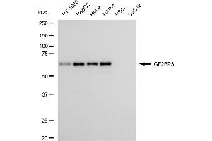 Western blotting analysis using IGF2BP3 antibody (ABIN7799052).