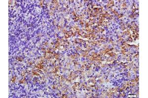 Paraformaldehyde-fixed, paraffin embedded mouse spleen tissue, Antigen retrieval by boiling in sodium citrate buffer(pH6) for 15min, Block endogenous peroxidase by 3% hydrogen peroxide for 30 minutes, Blocking buffer (normal goat serum) at 37°C for 20min, Antibody incubation with Rabbit Anti-EIF2AK2/PKR Polyclonal Antibody, Unconjugated  at 1:500 overnight at 4°C, followed by a conjugated secondary and DAB staining (E2AK2/PKR anticorps  (AA 251-360))