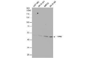 WB Image TPH2 antibody detects TPH2 protein by western blot analysis. (Tryptophan Hydroxylase 2 anticorps)