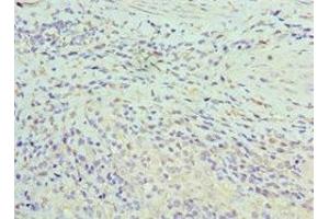 Immunohistochemistry of paraffin-embedded human epityphlon tissue using ABIN7155295 at dilution of 1:100 (ASF1A anticorps  (AA 1-204))