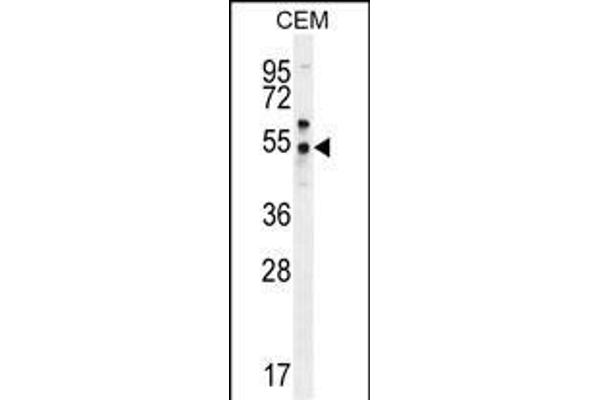 FOLH1B anticorps  (C-Term)