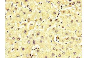 IHC image of ABIN7143616 diluted at 1:350 and staining in paraffin-embedded human liver tissue performed on a Leica BondTM system.