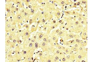IHC image of ABIN7143616 diluted at 1:350 and staining in paraffin-embedded human liver tissue performed on a Leica BondTM system. (ALT anticorps  (AA 2-496))
