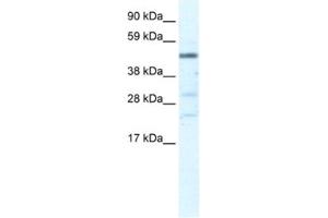 Western Blotting (WB) image for anti-Heat Shock Transcription Factor, Y-Linked 1 (HSFY1) antibody (ABIN2461287)