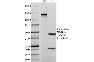 SDS-PAGE Analysis Purified TACSTD2 / TROP2 Mouse Monoclonal Antibody (TACSTD2/2152). (TACSTD2 anticorps  (AA 31-274))