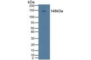Detection of PLCg2 in Human Raji Cells using Polyclonal Antibody to Phospholipase C Gamma 2, Phosphatidylinositol Specific (PLCg2) (Phospholipase C gamma 2 anticorps  (AA 930-1152))