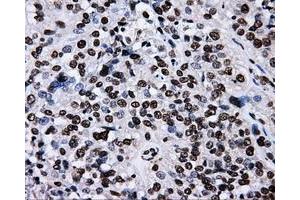 Image no. 5 for anti-RalA Binding Protein 1 (RALBP1) antibody (ABIN1500585)