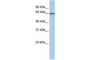 Human Brain; WB Suggested Anti-AHCYL1 Antibody Titration: 0. (AHCYL1 anticorps  (N-Term))