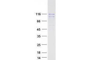 Validation with Western Blot