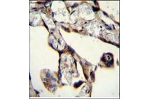 Immunohistochemistry analysis in Formalin Fixed, Paraffin Embedded Human placenta tissue stained with SASH1 Antibody (N-term) followed by peroxidase conjugation of the secondary antibody and DAB staining. (SASH1 anticorps  (Middle Region))