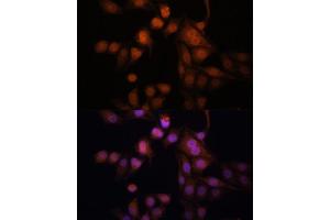 Immunofluorescence analysis of HeLa cells using Twist antibody (ABIN6128846, ABIN6149715, ABIN6149718 and ABIN6223153) at dilution of 1:100. (TWIST1 anticorps  (AA 103-202))