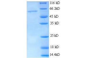 Thrombospondin 3 (THBS3) (AA 24-350), (partial) protein (His tag)