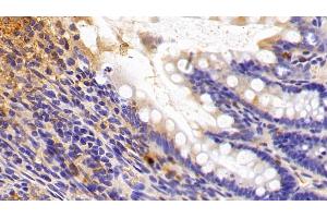 Detection of SIRT3 in Rat Colon Tissue using Polyclonal Antibody to Sirtuin 3 (SIRT3) (SIRT3 anticorps  (AA 127-303))