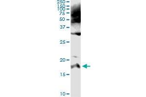 Immunoprecipitation of SPINK1 transfected lysate using anti-SPINK1 monoclonal antibody and Protein A Magnetic Bead , and immunoblotted with SPINK1 MaxPab rabbit polyclonal antibody.