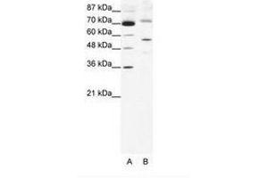Image no. 1 for anti-Sirtuin 3 (SIRT3) (AA 152-201) antibody (ABIN203108) (SIRT3 anticorps  (AA 152-201))