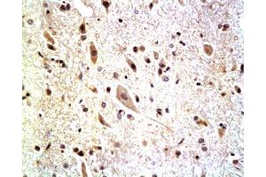 Formalin-fixed and paraffin embedded: rat spinal cord tissue labeled with Anti-Neurofascin Polyclonal Antibody, Unconjugated  at 1:200, followed by conjugation to the secondary antibody and DAB staining