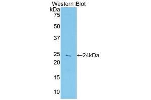 Western blot analysis of the recombinant protein. (Peroxiredoxin 5 anticorps  (AA 1-210))