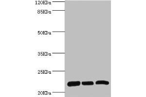 Western blot All lanes: RPL9 antibody at 0. (RPL9 anticorps  (AA 1-192))