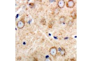 anti-Peripheral Myelin Protein 22 (PMP22) (C-Term) antibody
