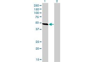 Western Blot analysis of C9orf98 expression in transfected 293T cell line by C9orf98 monoclonal antibody (M01), clone 3B8.