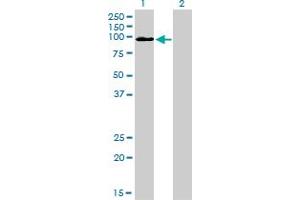 Western Blot analysis of MCC expression in transfected 293T cell line by MCC monoclonal antibody (M01), clone 1A7. (MCC anticorps  (AA 31-130))