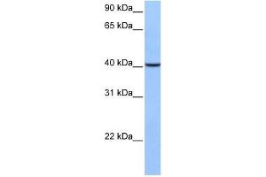 AGBL5 antibody used at 1 ug/ml to detect target protein. (AGBL5 anticorps  (C-Term))