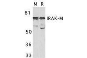 Western Blotting (WB) image for anti-Interleukin-1 Receptor-Associated Kinase 3 (IRAK3) (C-Term) antibody (ABIN2475133)