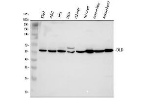 Western blot analysis of DLD using anti-DLD antibody (ABIN3043561). (DLD anticorps  (AA 300-509))