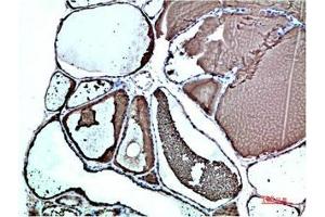 Immunohistochemical analysis of paraffin-embedded Human Thyroid Tissue using TTR Mouse mAb diluted at 1:200.