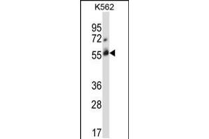 Western blot analysis in K562 cell line lysates (35ug/lane). (CBLC anticorps  (C-Term))