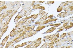 Immunohistochemistry of paraffin-embedded Mouse heart using SLC25A5 Polyclonal Antibody at dilution of 1:100 (40x lens). (SLC25A5 anticorps)