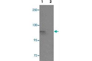 Western blot analysis of SCUBE1 in Daudi cell lysate with SCUBE1 polyclonal antibody  at 1 ug/mL in (1) the absence and (2) the presence of blocking peptide. (SCUBE1 anticorps  (Internal Region))