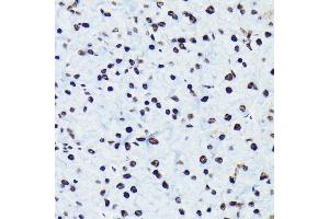 Immunohistochemistry of paraffin-embedded rat pancreas using Phospho-Rb-S780 antibody (ABIN7269936) at dilution of 1:100 (40x lens).