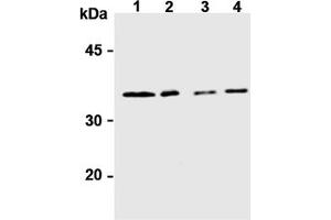 Western Blotting (WB) image for anti-Syntaxin 6 (STX6) antibody (ABIN492572) (Syntaxin 6 anticorps)
