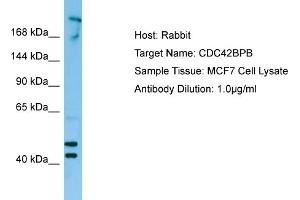 Western Blotting (WB) image for anti-CDC42 Binding Protein Kinase beta (DMPK-Like) (CDC42BPB) (C-Term) antibody (ABIN2790145) (CDC42BPB anticorps  (C-Term))