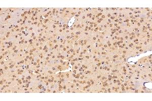 Detection of C3 Convertase in Mouse Cerebrum Tissue using Polyclonal Antibody to Complement C3 Convertase (C3 Convertase) (Complement C3 Convertase anticorps)