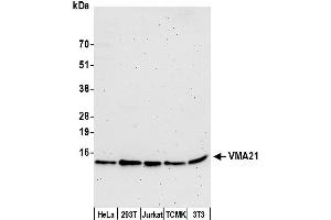 Western Blotting (WB) image for anti-Vacuolar H+-ATPase Homolog (VMA21) (AA 1-50) antibody (ABIN7452644)