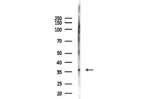 anti-NK3 Homeobox 1 (NKX3-1) (Internal Region) antibody