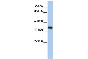 C6ORF140 antibody used at 1 ug/ml to detect target protein. (GLYATL3 anticorps  (N-Term))