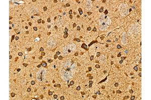 ABIN6265513 and ABIN6276479 at 1/100 staining Mouse brain tissue by IHC-P. (TDGF1 anticorps  (Internal Region))