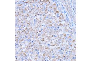 Immunohistochemistry of paraffin-embedded rat ovary using MT-ND1 antibody (ABIN7268598) at dilution of 1:100 (40x lens). (MT-ND1 anticorps)