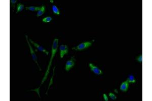 Immunofluorescence staining of Hela cells with ABIN7153315 at 1:100, counter-stained with DAPI.