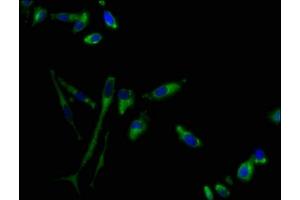 Immunofluorescence staining of Hela cells with ABIN7153315 at 1:100, counter-stained with DAPI. (G Protein-Coupled Receptor 1 anticorps  (AA 308-355))
